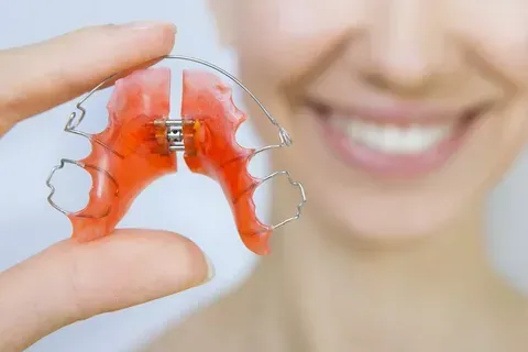 Hand holding a transparent red retainer for teeth alignment.