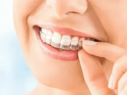 Close-up of a person adjusting a clear dental aligner on their teeth.
