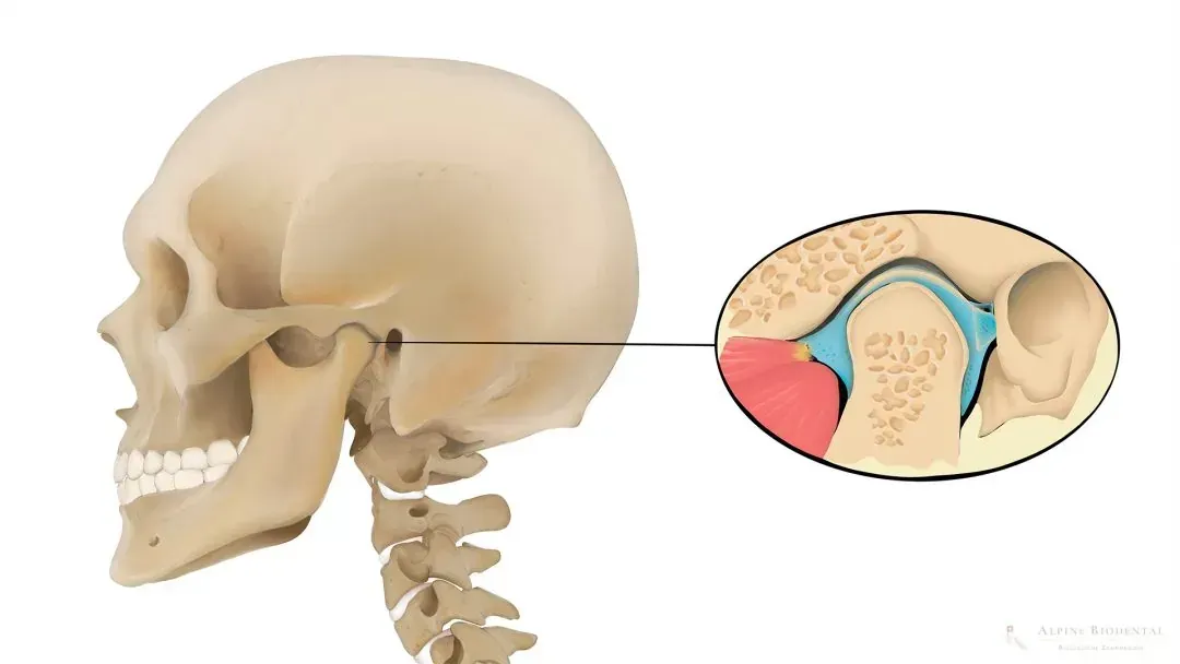 Illustration of a human skull with a focus on the ear canal and detailed inset of the ear structure