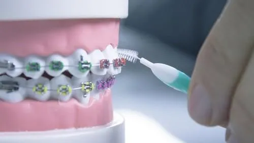 A hand uses an interdental brush to clean colorful braces on a dental model.