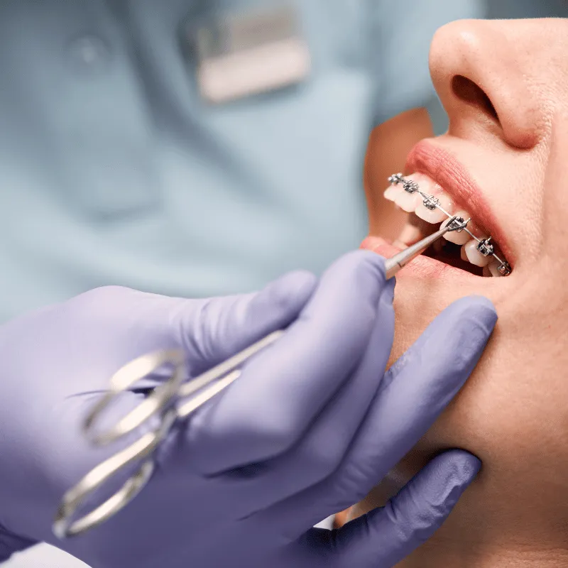 A dentist in gloves uses a dental tool on a young patient sitting in a dental chair, covered with a bib and headrest.