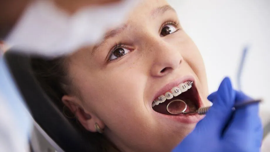A Child with braces during a Ortho check-up, gloved hand holding tools.