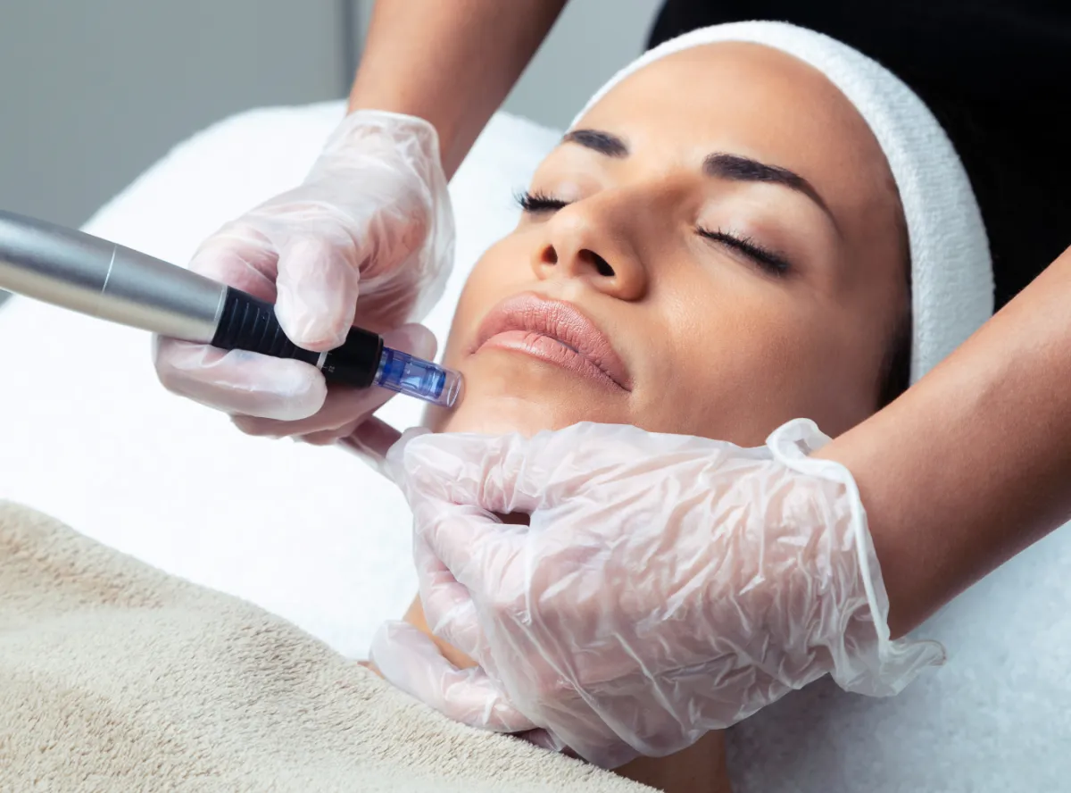 woman receiving micro needling for smooth beautiful skin