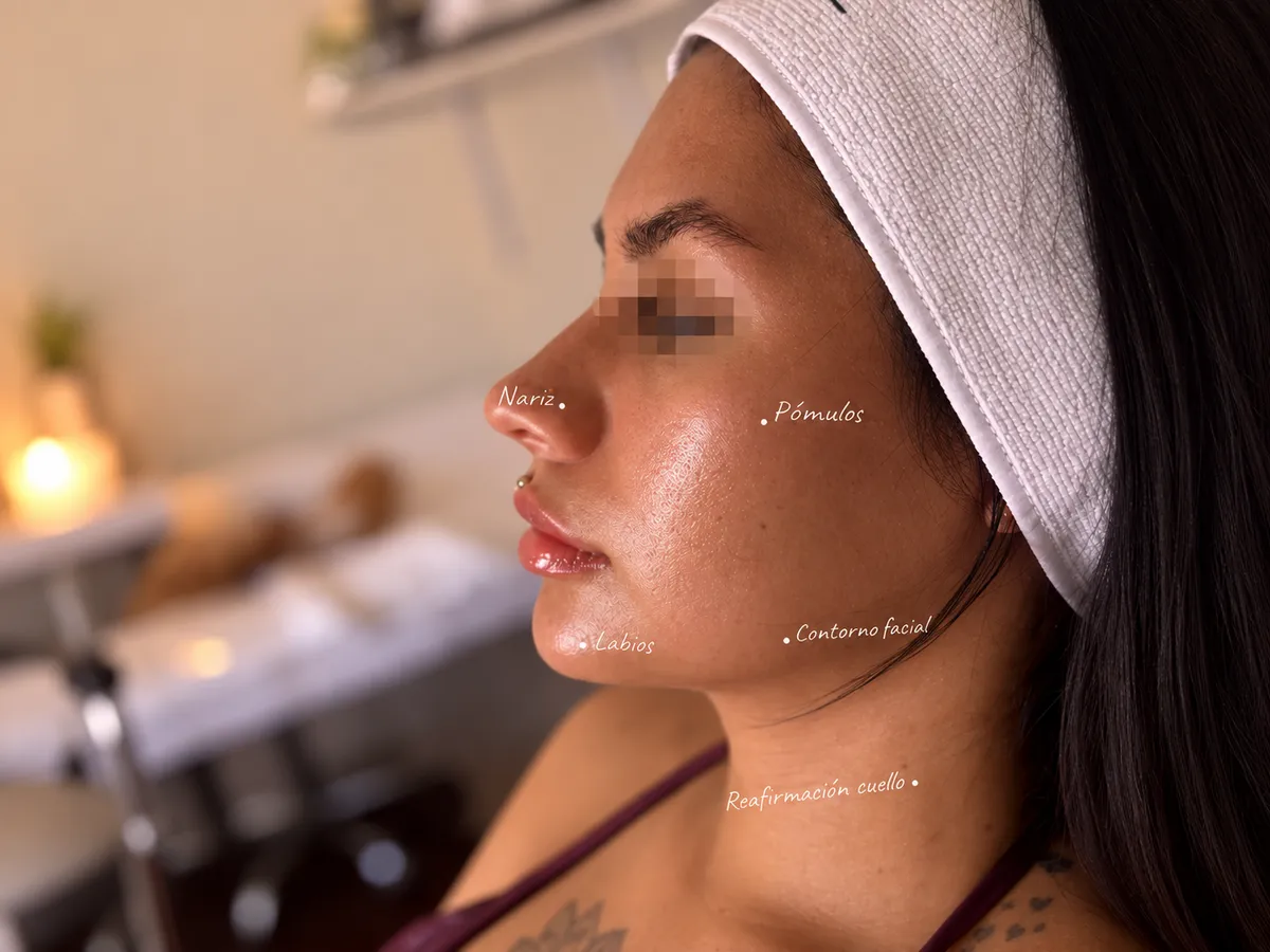 Perfilación facial