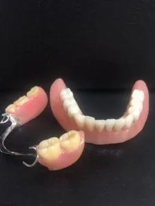 Affordable dentures in Markham Dental 