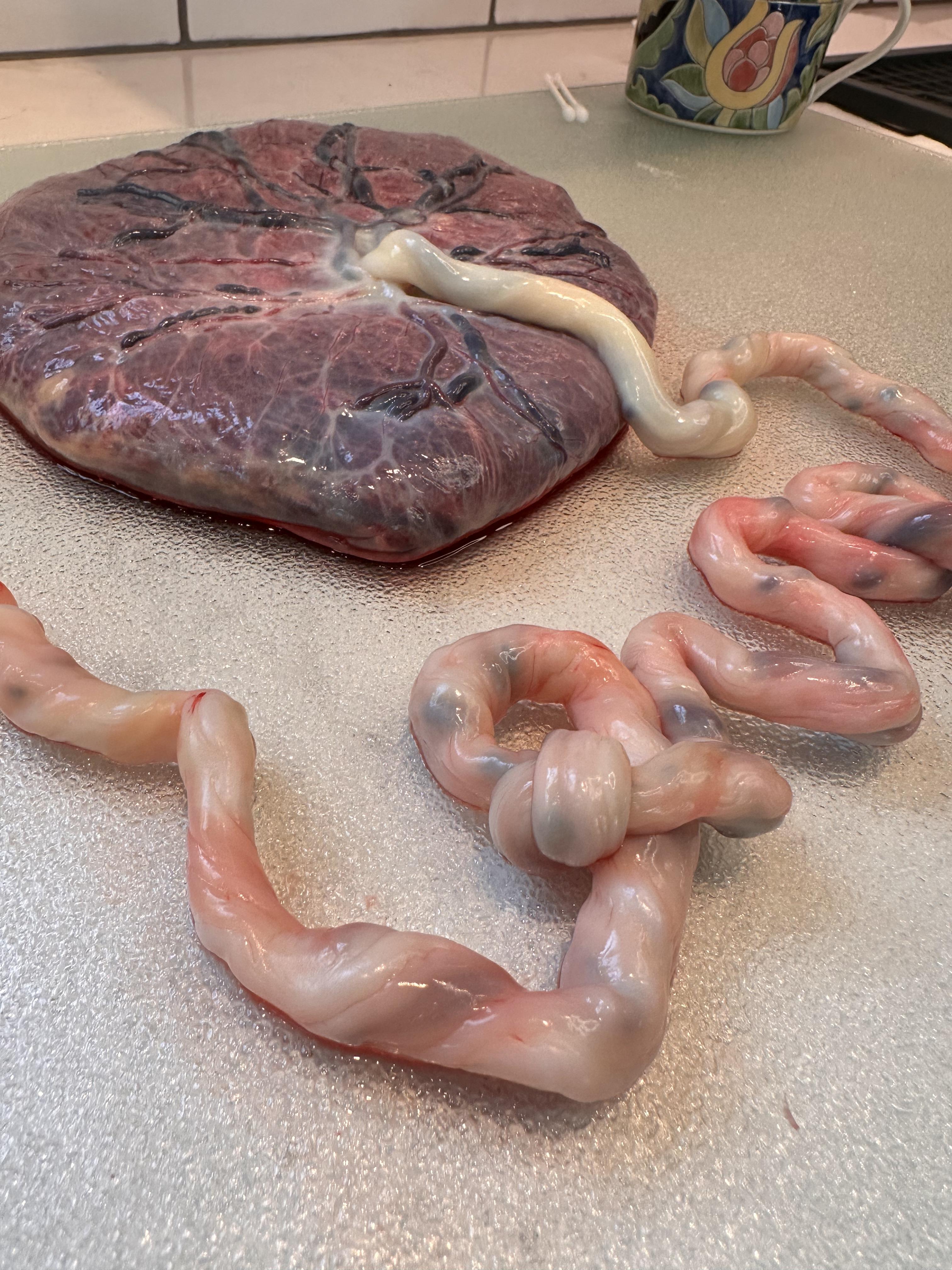 Placenta photo