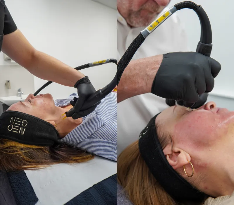 T-Shape 2 at Amati Aeshetis, Body Shaping, Skin Tighining, face lift at amati aesthetic.