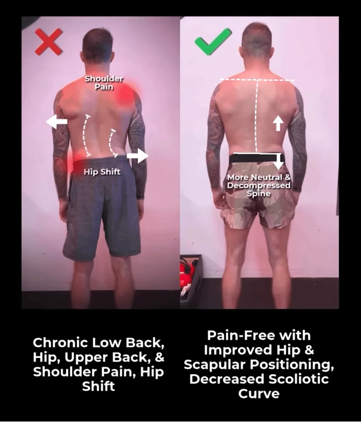 man-Functional-Patterns-MN-Pain, Posture & Performance Relief Workshop