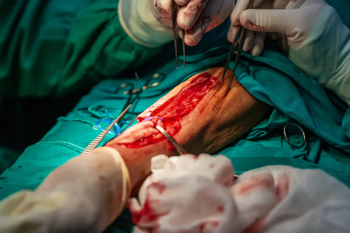 Skin grafts and flap surgery are essential for reconstructing areas where skin has been lost due to injury, burns, or surgery. 