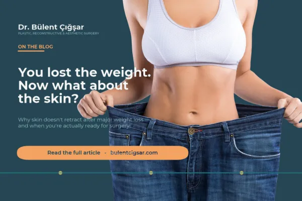 Loose skin after weight loss and surgical timing