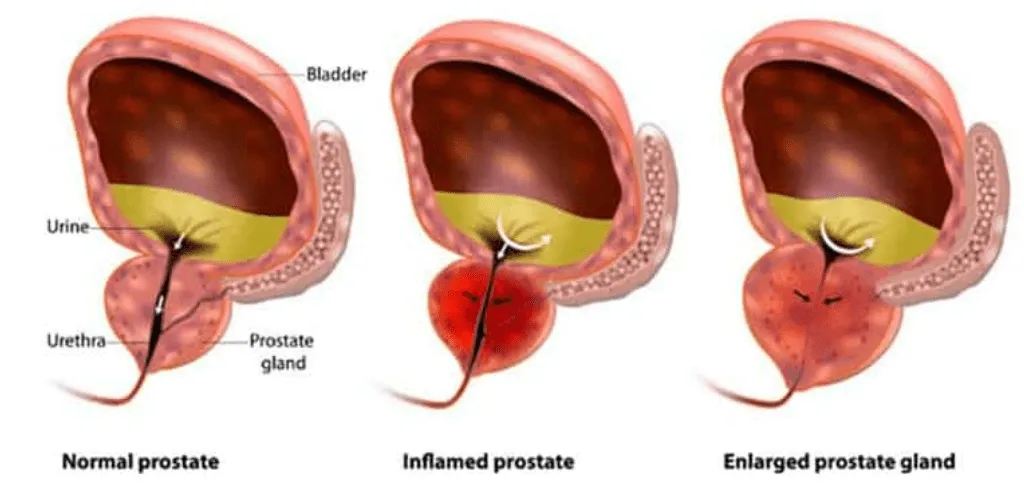 Healthy prostate
