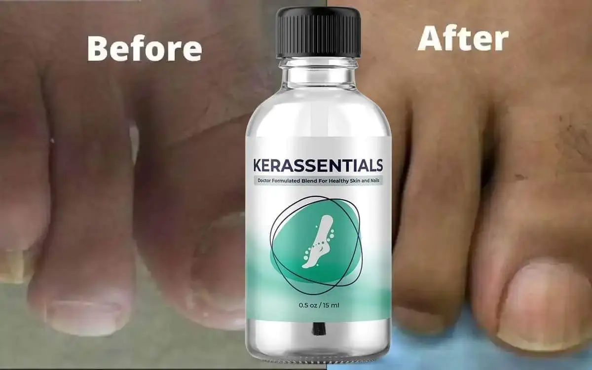 Kerassentials before and after results