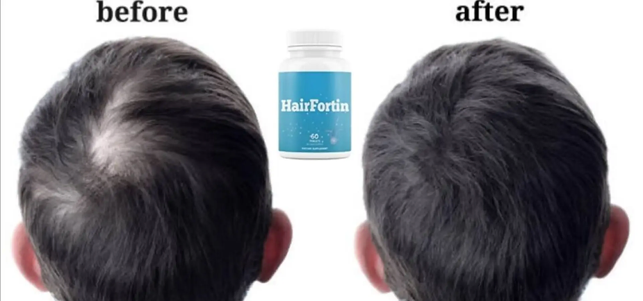 HairFortin buy