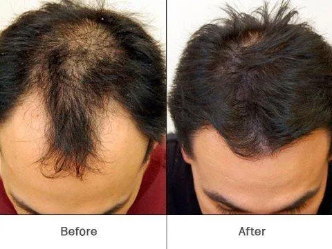 HairFortin dietary supplement
