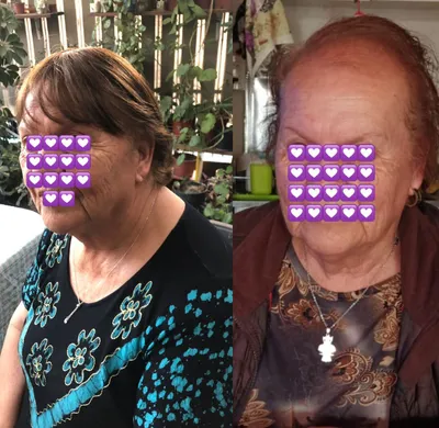Adultas mayores usando peluca oncológica con ondas suaves – testimonio real en Pelucas Avatte