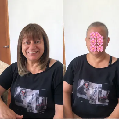 Mujer antes y después con peluca oncológica lisa – apoyo estético durante quimioterapia