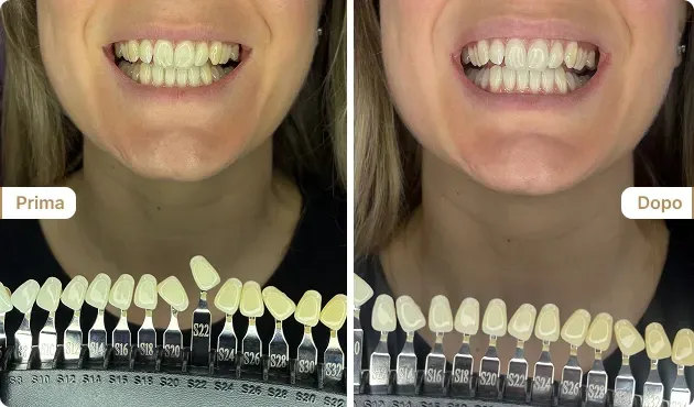 Before and After