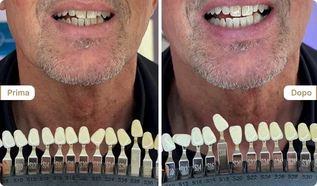 Before and After