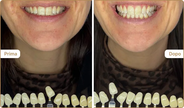 Before and After