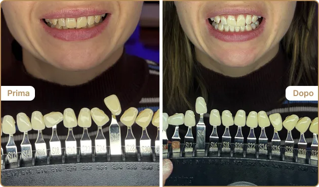 Before and After
