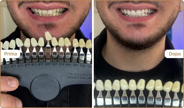 Before and After