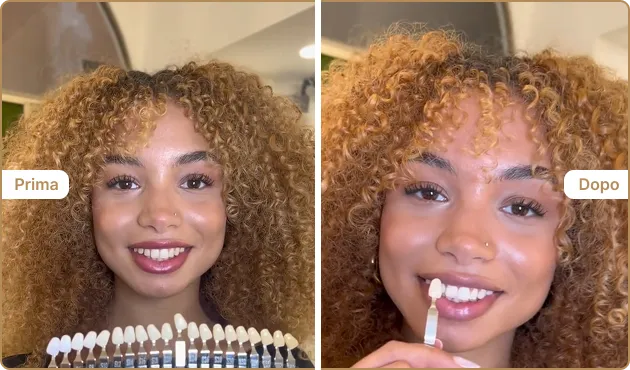 Before and After