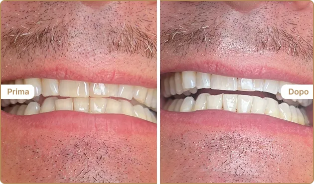Before and After