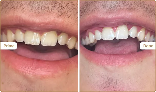 Before and After