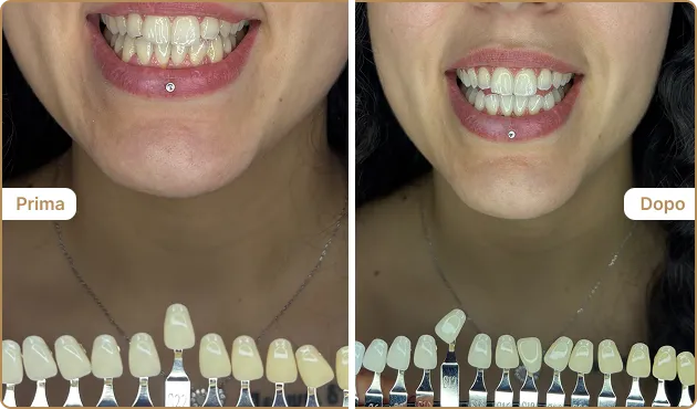 Before and After