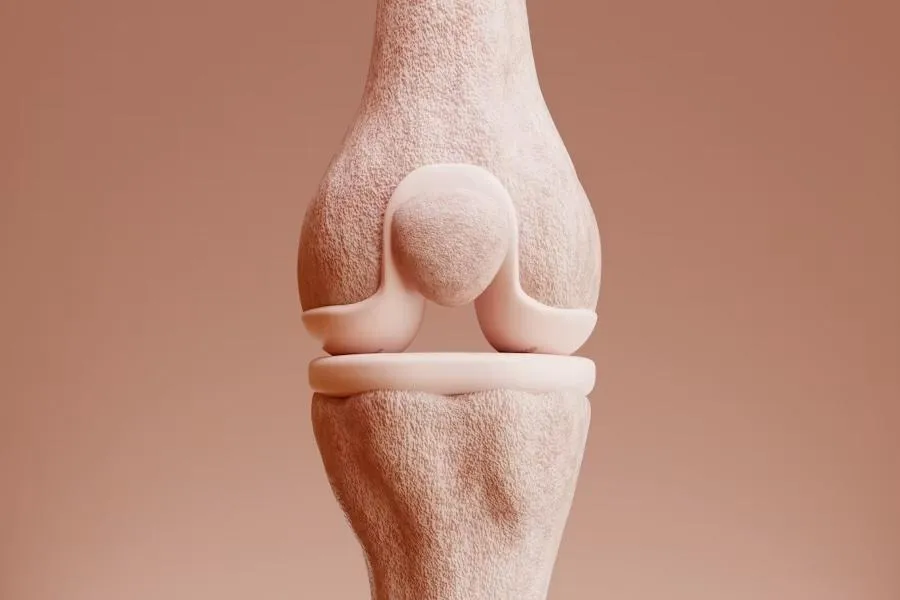 5 Things I Wish Everyone Knew Before a Knee Replacement