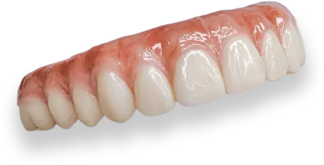 all on four teeth