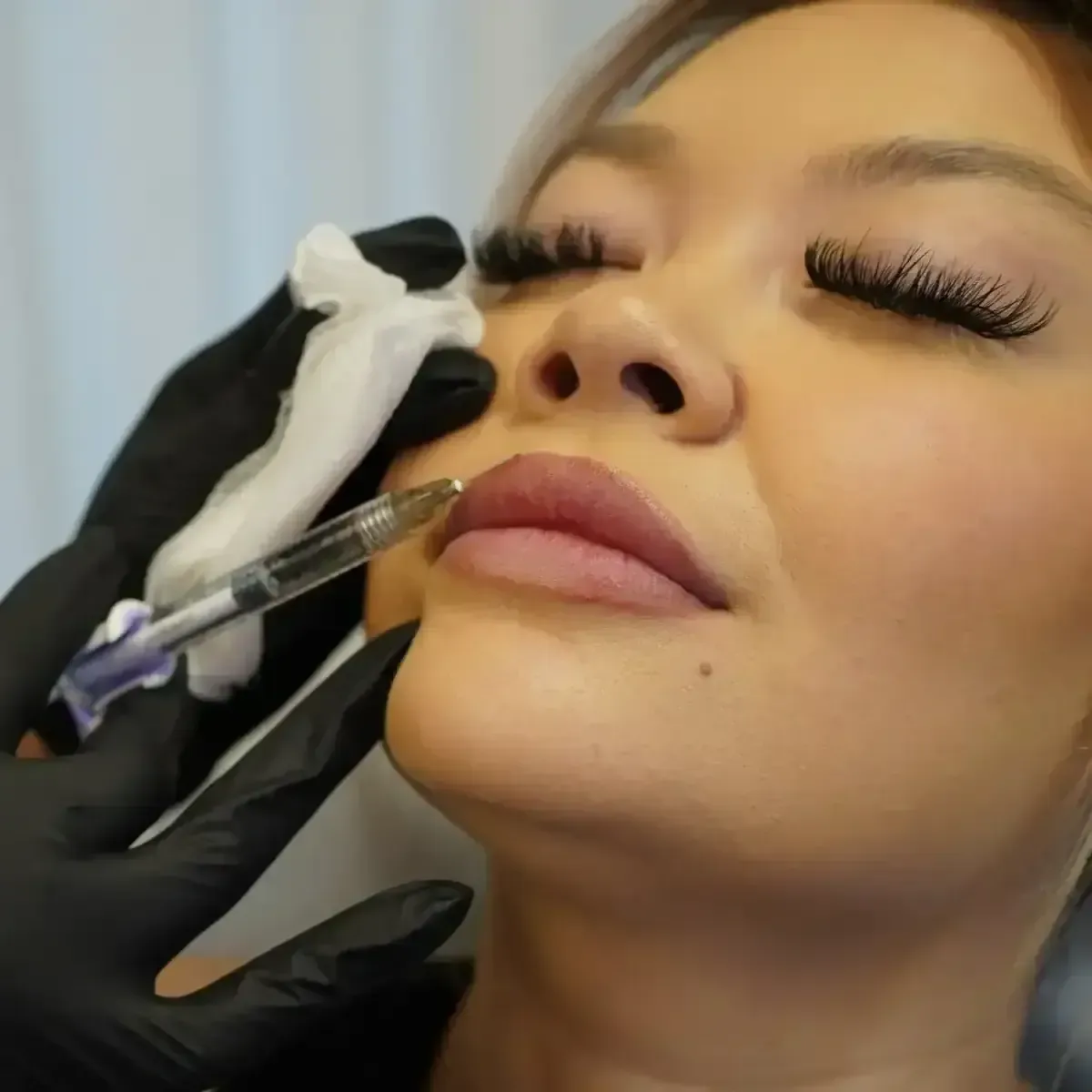 A woman getting a Derma Filler in Chrome Aesthetics
