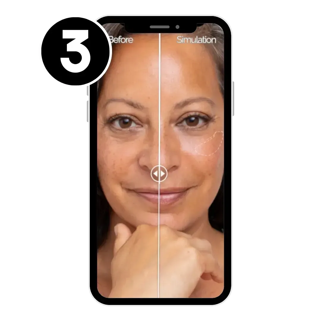 EntityMed AI Simulator Step 3: Compare before and after images side by side to visualize treatment results.