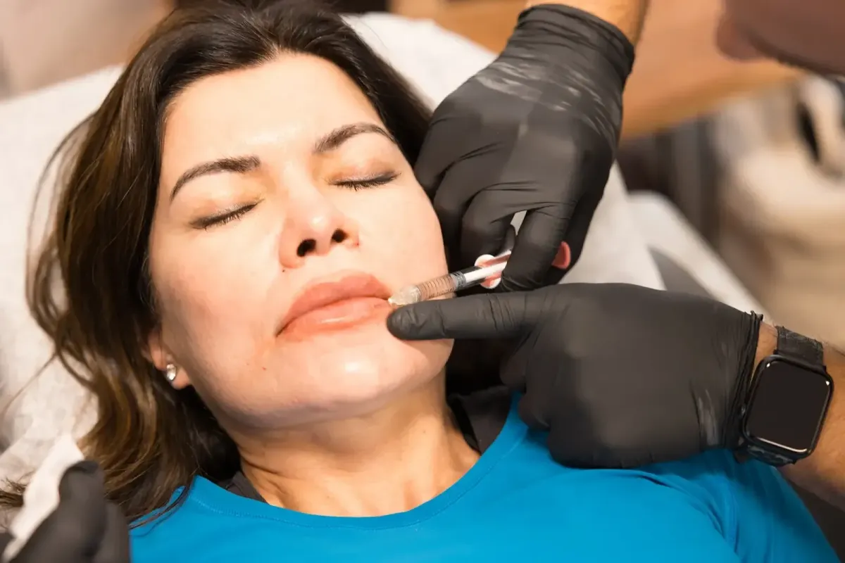 Gloved medical professional administers a cosmetic injection near the mouth of a relaxed middle-aged woman lying down with eyes closed.