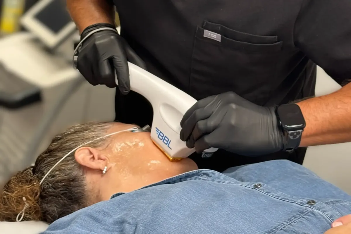 Gloved practitioner performs BBL laser treatment on the face of a patient with cooling gel applied in a clinical setting.