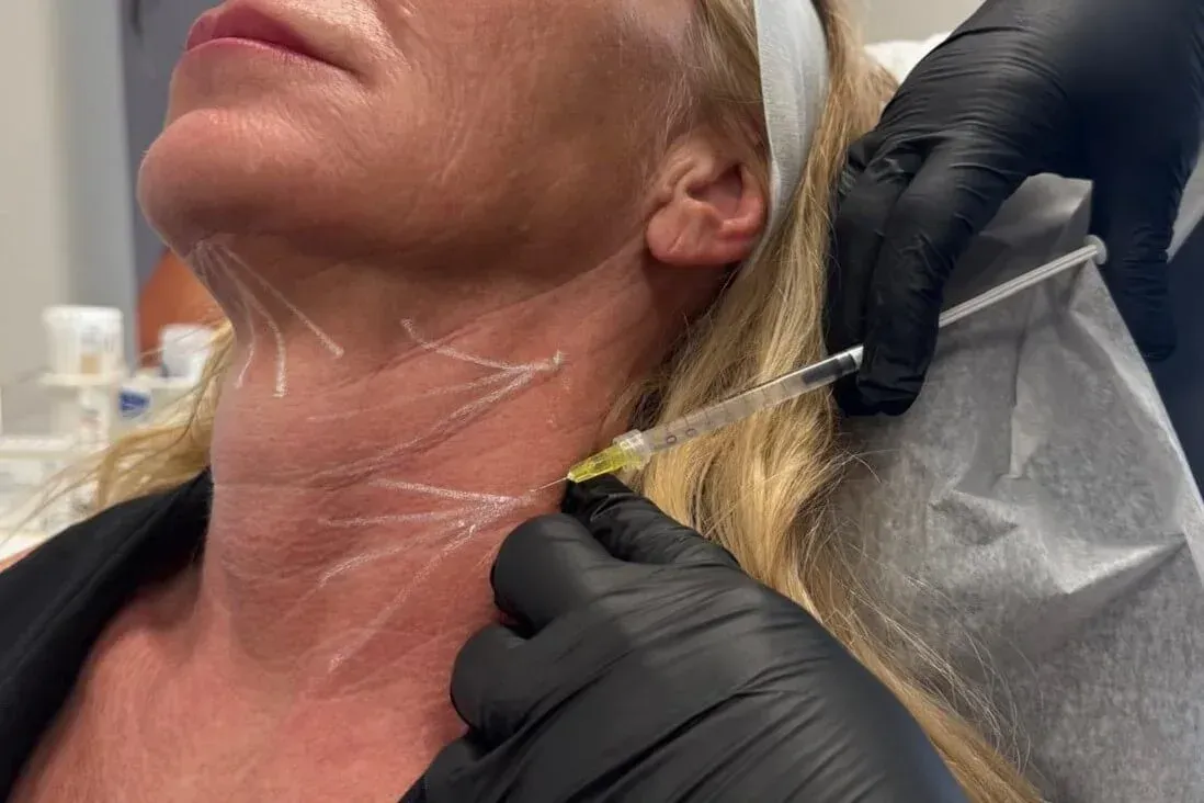The Treatment Everyone Asks About and the Area We Forget