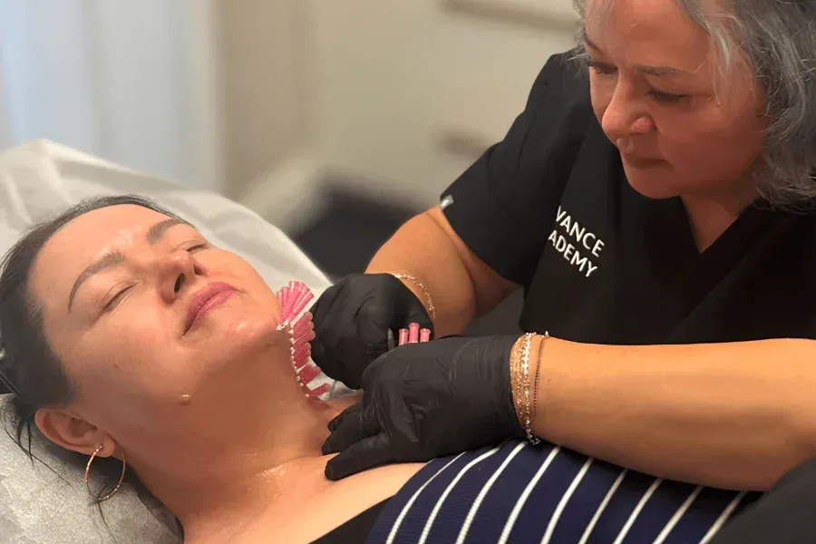 Practitioner performing a PDO Thread Lift on a patient with threads placed along the jawline and neck during a treatment session at Chrome Aesthetics.
