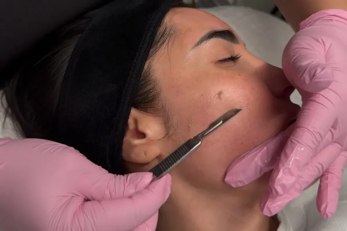 Provider performing dermaplaning treatment on patient's cheek at Chrome Aesthetics Spa