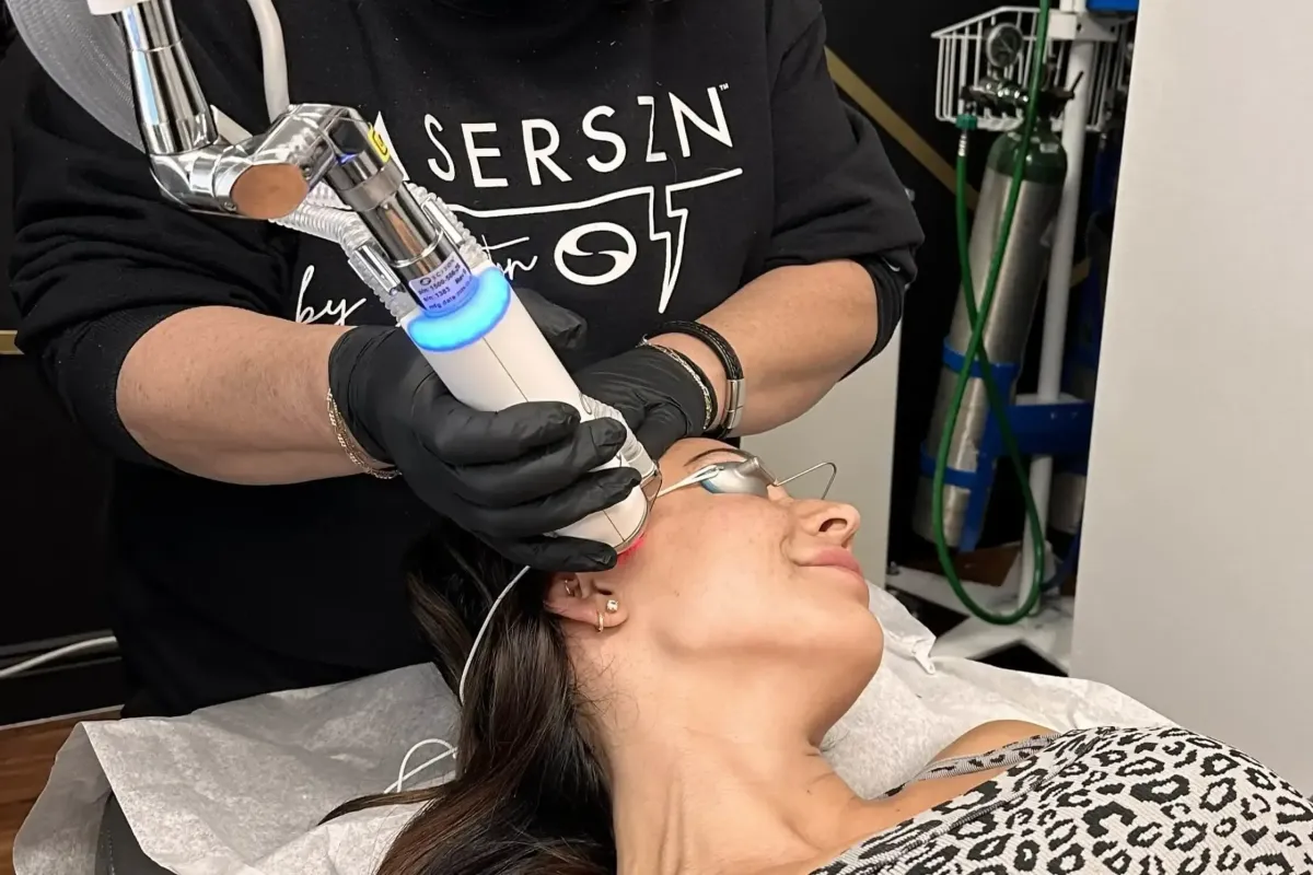 BBL BroadBand Light treatment for acne clearing on patient's neck and jawline at Chrome Aesthetics Spa
