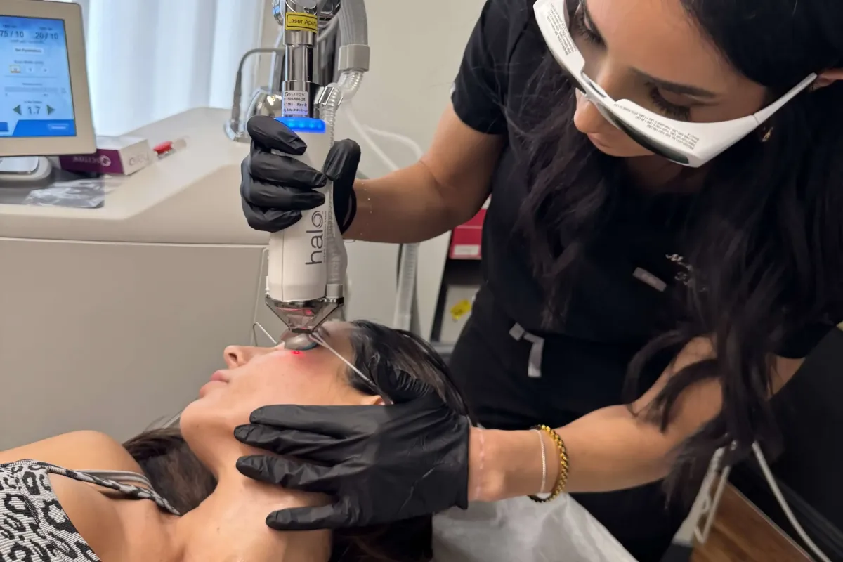 Provider performing Halo hybrid fractional laser treatment on female patient's face at Chrome Aesthetics Spa