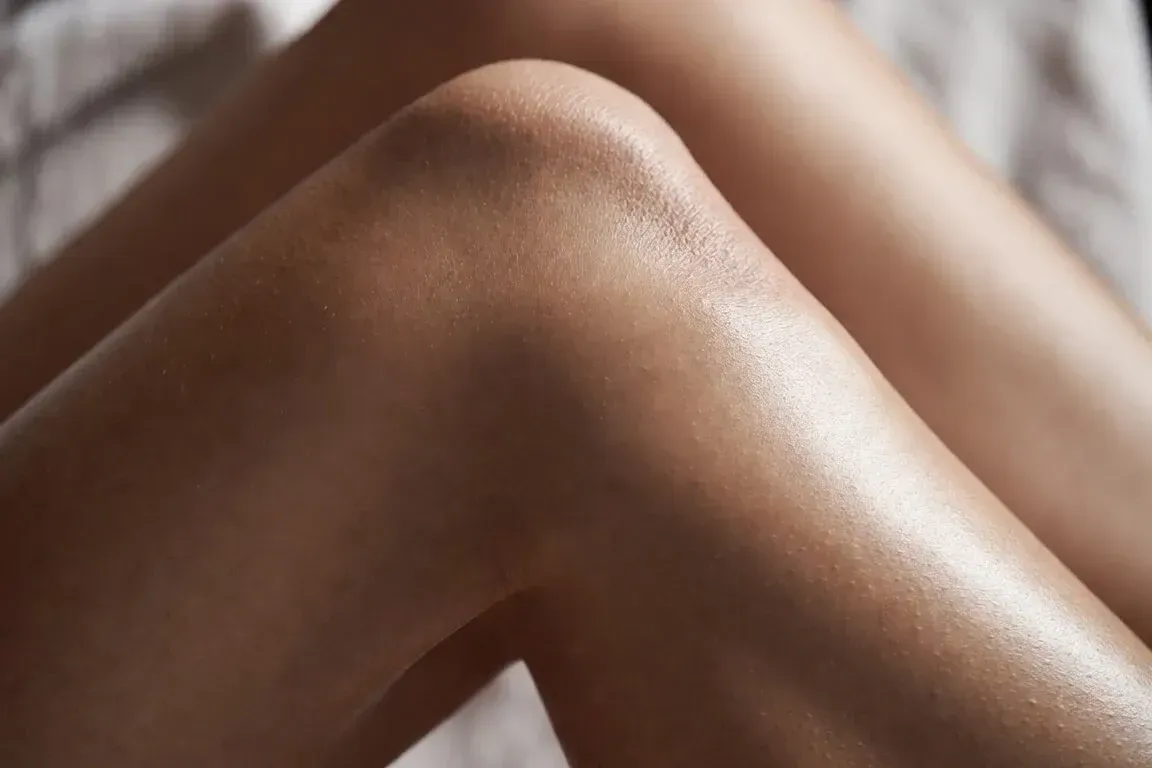 Smooth, radiant leg skin after BBL BroadBand Light photofacial treatment at Chrome Aesthetics Spa