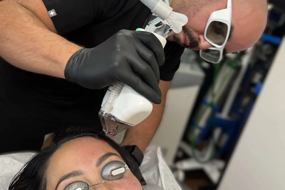 Provider performing Forever Bare BBL laser hair removal treatment on patient's forehead at Chrome Aesthetics Spa