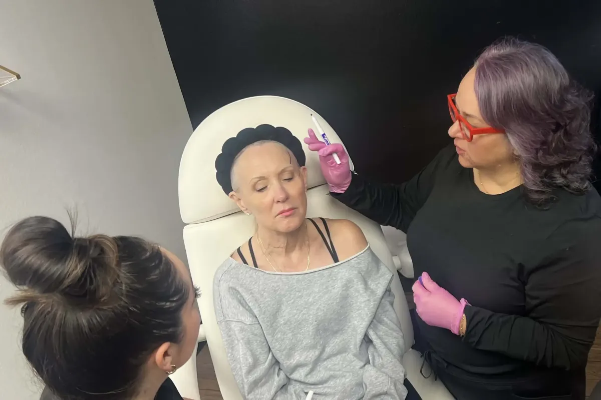 Providers marking treatment areas before Morpheus8 microneedling on patient's lower face at Chrome Aesthetics Spa