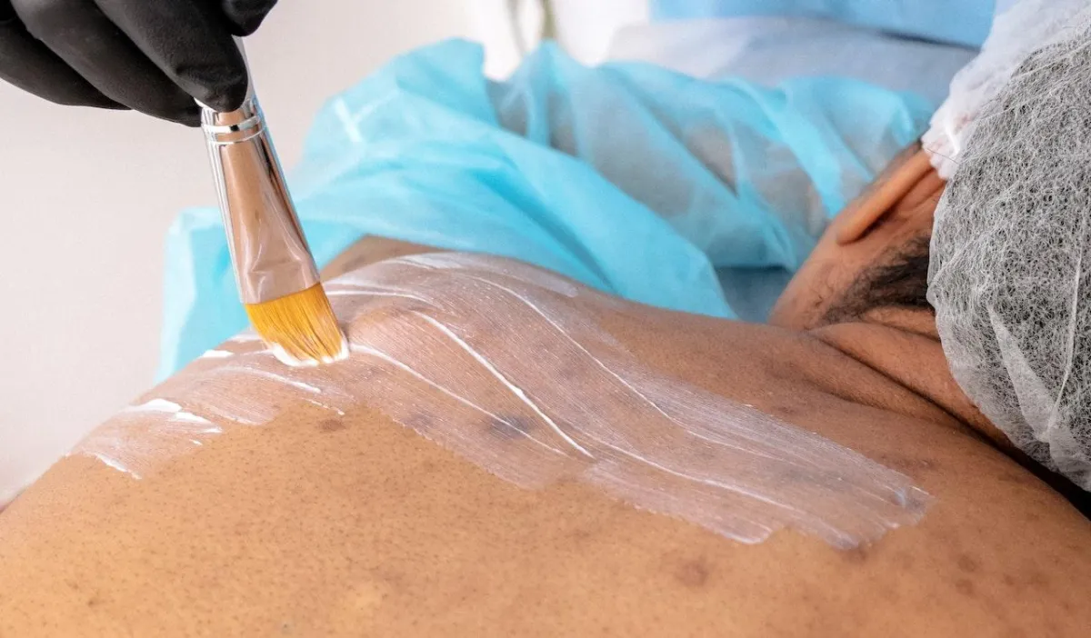 EN Spa Back Acne Treatment