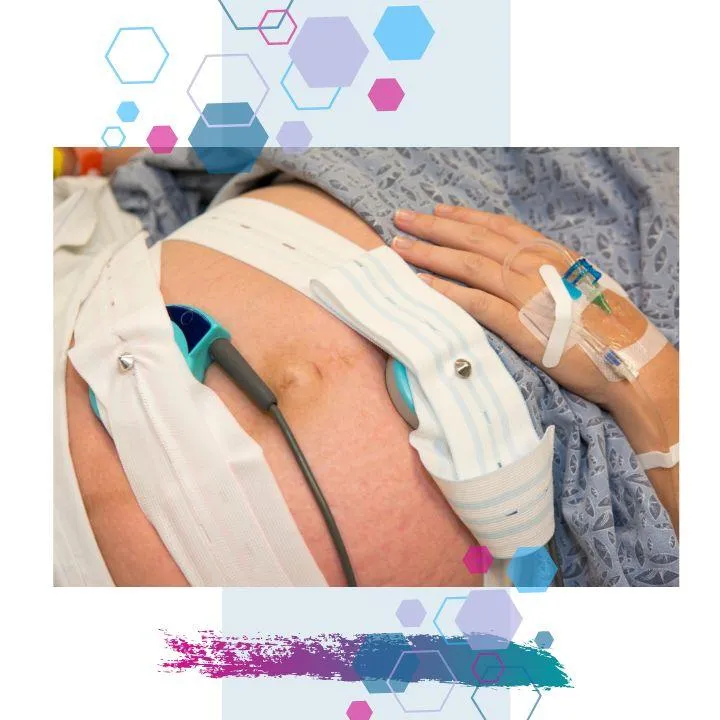 A pregnant belly with monitoring equipment on, and elastic bands holding them in place. There is a hand with a cannula attached. A medicalised birth.