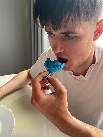 step 3: choose tray that fits best for dental impression