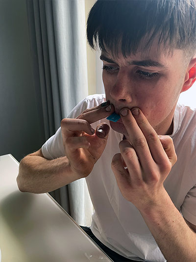 step 9: press tray to capture full dental impression