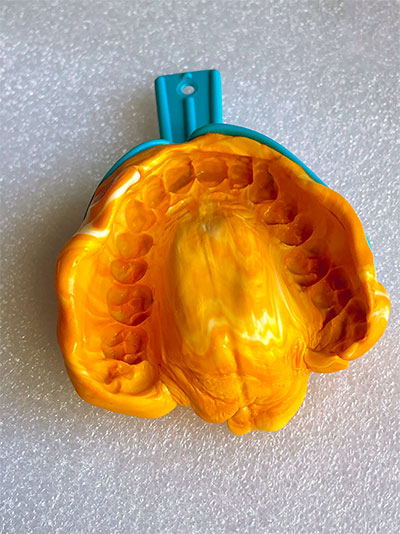 step 12: inspect impression before returning