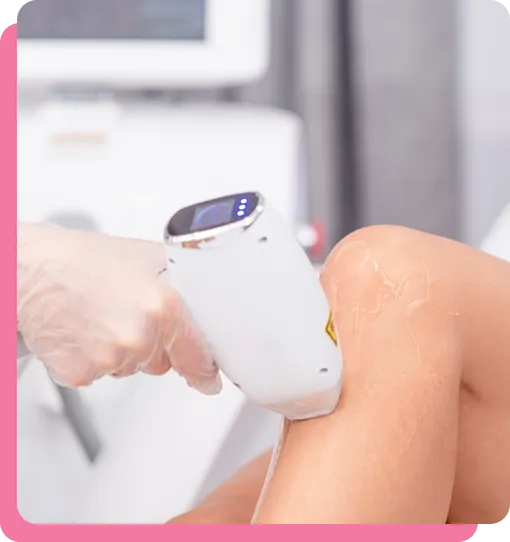 Gloss Medical Aesthetics & Laser website builder showing a close-up of a Cynosure Elite IQ handpiece performing laser hair removal on a client's arm in Baltimore.