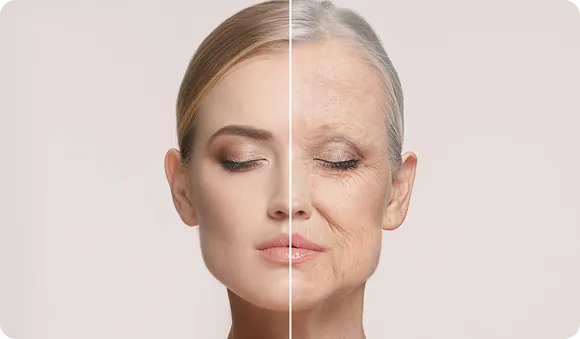 Aging